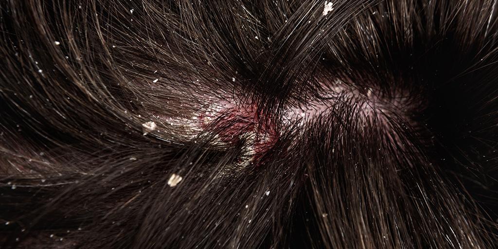 non comedogenic curly hair products